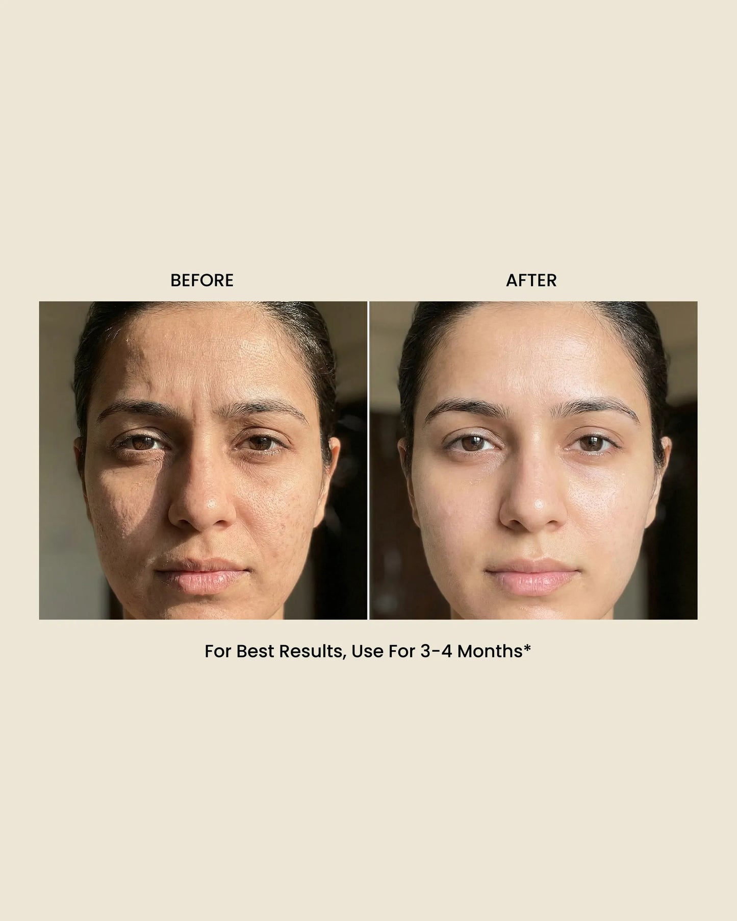 Nature's Botox: Anti Ageing Cream