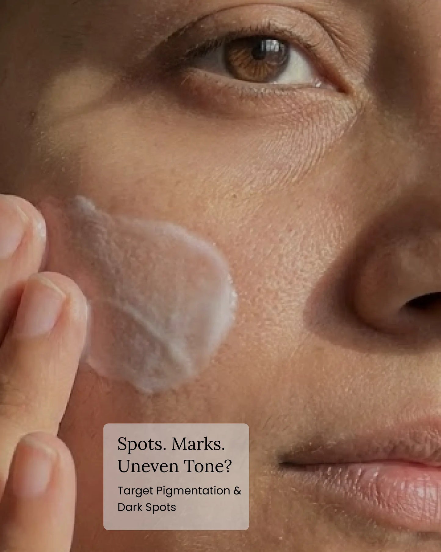 Blemish Cream