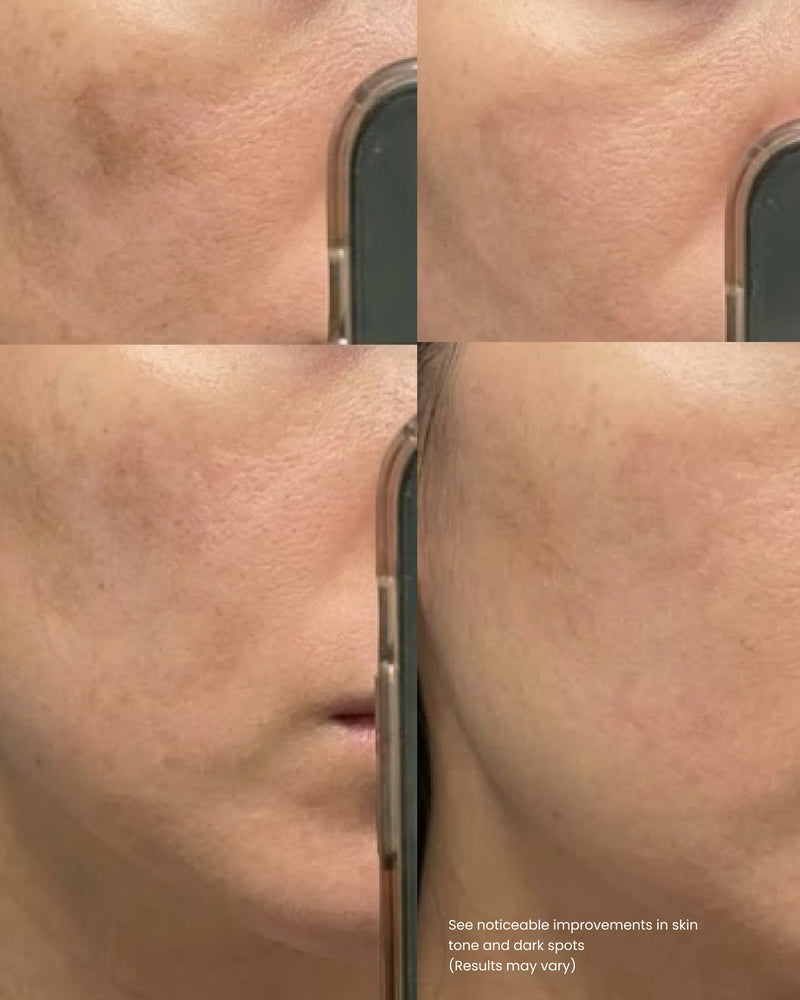 Blemish Cream
