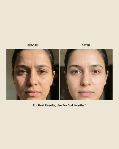 Nature's Botox: Anti Ageing Cream