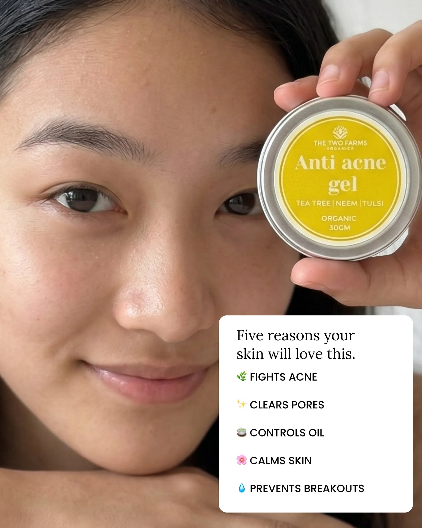 Anti Acne Gel