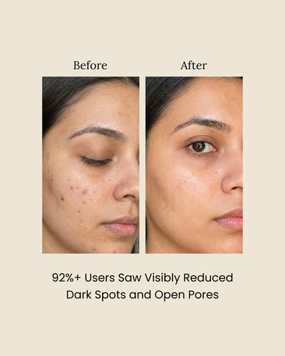 Unbeatable Glow Serum